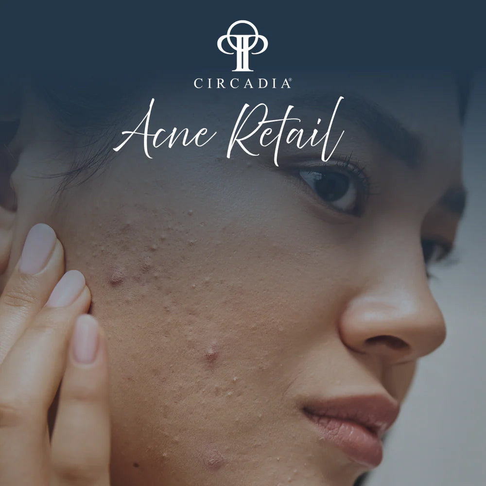 Acne Retail Bundle - Summer Offer
